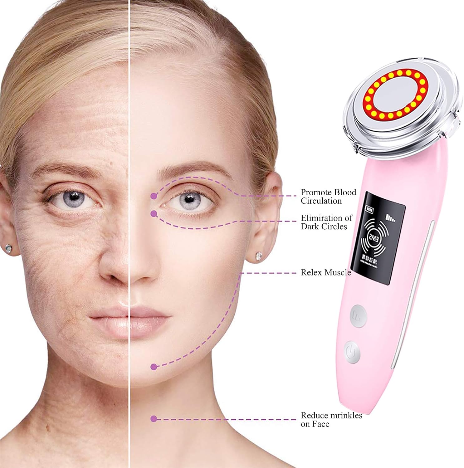 Skin Rejuvenation Device